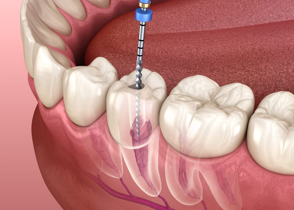 Saving Smiles with Gentle Care