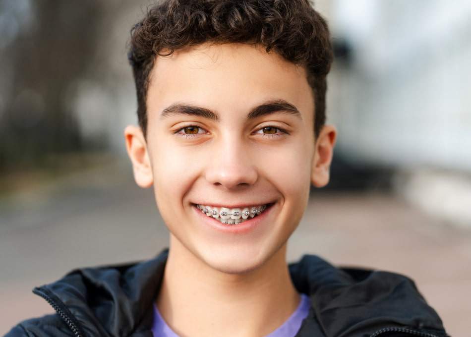 Creating Beautiful Smiles